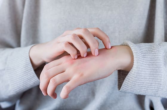 アレルギー・膠原病