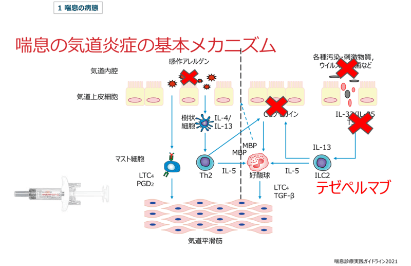 喘息の気道炎症の基本メカニズム④