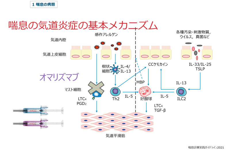 喘息の気道炎症の基本メカニズム①